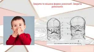 Закрита та мішана форми ринолалії. Закрита ринолалія.
