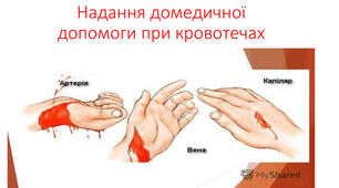Надання домедичної допомоги при кровотечах