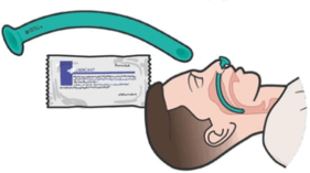 06005dkc-bc0b-281x157.png