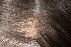 06009699-273b-250x163.png