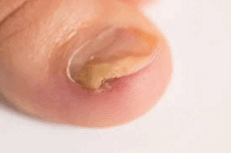 0600969u-9d3a-231x153.png