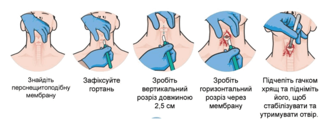 06009993-8ded-666x246.png