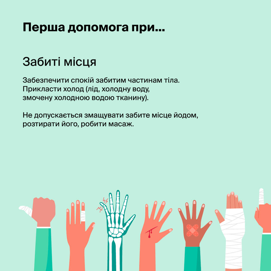 перша допомога при забитих місцях