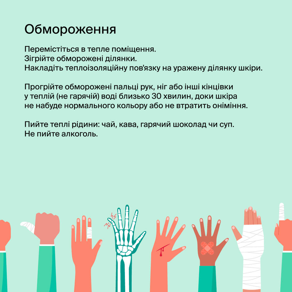 перша допомога при обмороженні