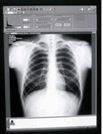 0600ahec-f815-209x270.png