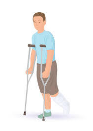 File:Broken Leg.png - Wikipedia