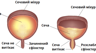 Сечовидільна система
