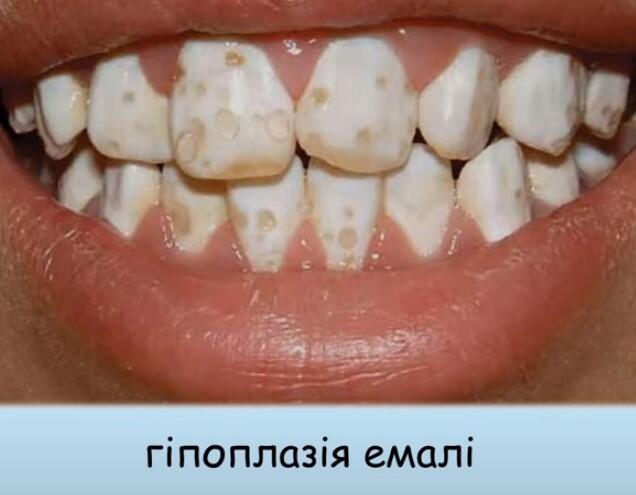 0600cv1u-10c3-636x495.jpg