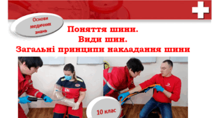 Види шин. Принципи накладання шин на кінцівки 