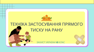 Презентація на тему: "Техніка застосування прямого тиску на рану".