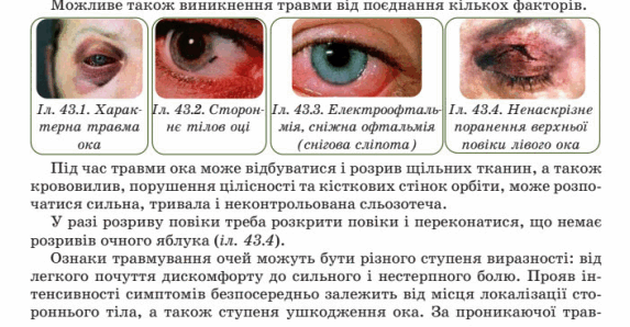 0600xrim-8e9e-573x298.png