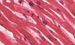 0600y8r6-32f6-154x93.png