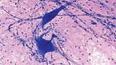 0600y8su-6339-163x92.png