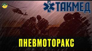 Тест 15. Проникні поранення грудей. 