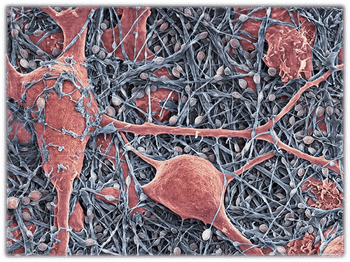06011l75-0ca3-701x526.png