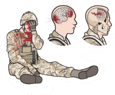 06013fds-5161-382x314.png