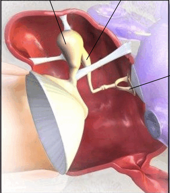 06014sfi-7b5e-560x635.png