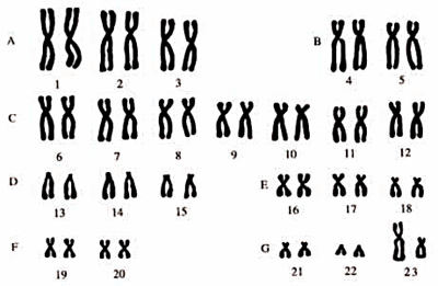 06018ibd-cd1c-400x261.png