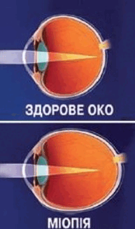0601ckyv-297d-193x327.png
