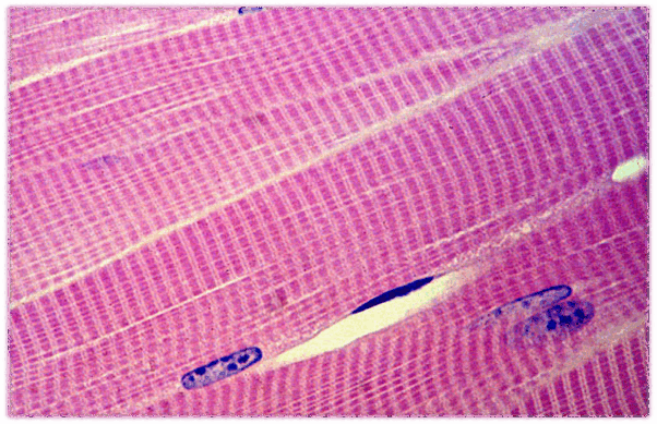 0601p8bt-3fe3-602x389.png