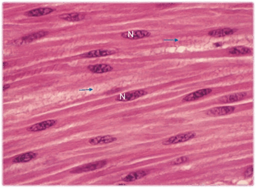 0601p8ev-0af0-509x374.png