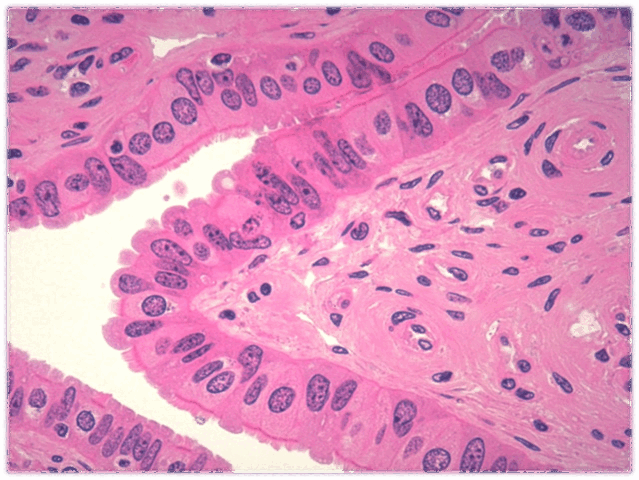 0601p8f9-5c44-639x480.png