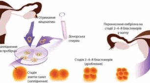(Копія) ОСОБЛИВОСТІ РЕПРОДУКЦІЇ ЛЮДИНИ У ЗВ'ЯЗКУ З ЇЇ БІОСОЦІАЛЬНОЮ СУТНІСТЮ
