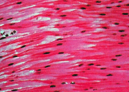 0601x0rm-5881-189x134.png