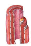 0601x2ls-ccab-107x159.png