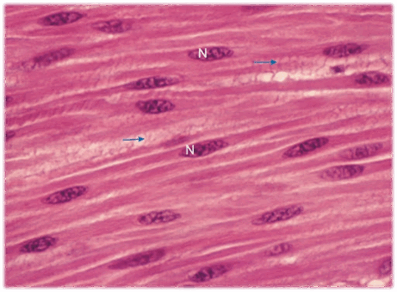 06021bj4-9070-558x410.png