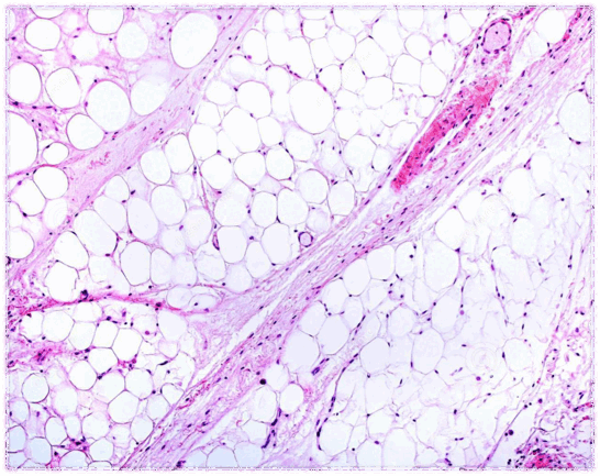 06021bp8-f309-546x433.png