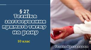 Презентація «Техніка застосування прямого тиску   на рану»