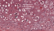0602a3bc-7085-224x131.png