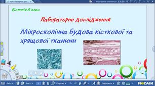 Лабораторне дослідження "Мікроскопічна будова кісткової та хрящової тканин"
