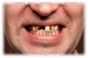 0602d66h-2468-285x190.png