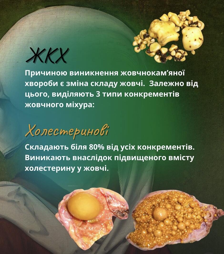0602j0kl-fadb-940x1065.jpg