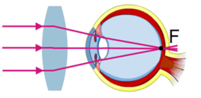 0602vebo-7223-293x143.png