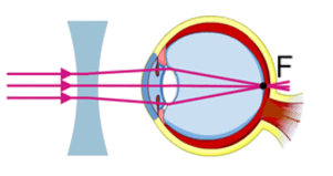 0602vec6-af82-301x159.png