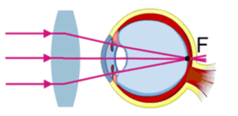 0602ved1-b177-341x167.png