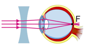 0602vedb-b761-312x155.png