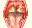 06037j46-5c5a-114x100.png