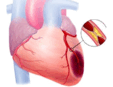 06037j59-7201-113x87.png