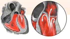 06037ziy-3660-282x157.png
