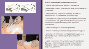 Презентація "Алгоритм надання домедичної допомоги за травми живота"