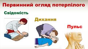 Алгоритм дій при раптовій зупинці серця. Основні правила проведення реанімації. Звільнення дихальних шляхів. Штучне дихання — його різновиди, методика та техніка проведення штучної вентиляції легенів.