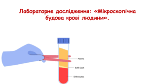 Лабораторне дослідження: «Мікроскопічна будова крові людини». 8 клас НУШ