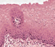 0603mndn-fd21-81x70.png