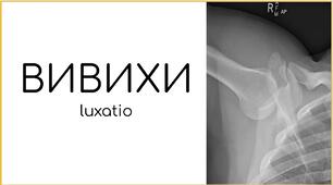 Вивихи